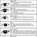 눈 모양 종류, 관상, 보는법, 달라짐 증상, 의심질환, 원인 이미지
