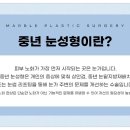 마블성형외과의원 네이버블로그