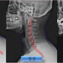 연세탄탄정형외과의원 네이버블로그
