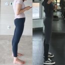 해피의료기 | 하체비만의 시작은 정상적으로 작동하지 않는 발아치때문입니다