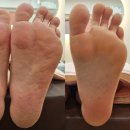 용민로 | 민락동발각질 퀸즈뷰티 의정부발관리 후기