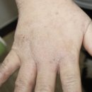 담뜰한의원 | 제주아토피치료 한의원 근심 내려 놓고