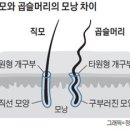 정수리에 돼지털(지랄머리)나는이유 이미지