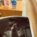 아이투비 산부인과 앞 | 임당 재검 주의사항 및 수치 (feat.아이투비 산부인과 후기)