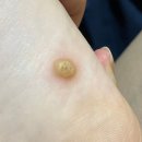 가경수피부과의원 이미지