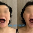 다이아에스테틱 이미지