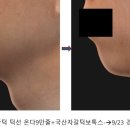 스프링의원 이미지