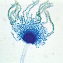 Re:Re: 아스퍼길루스 플라부스Aspergillus flavus: human pathogen, allergen and mycotoxin producer 이미지