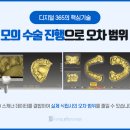 365디지털치과 이미지