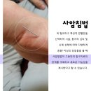 방패한의원 네이버블로그