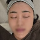 멍데이 살롱 | 내돈내산 관리데이 - 수원 광교 피부과 인모드 슈링크 보톡스 라라필 요즘 유행 귀여운 고양이 키티 네일