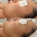 설스킨케어 네이버블로그
