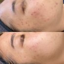 다온뷰티라인 | 대구 피부관리샵 다온뷰티 비교 후기