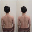 옥길동 우아다움 에스테틱 등관리 후기