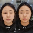 애드업플러스 | 마곡 양천향교피부관리 에르모듀 리프팅 케어 애드썸뷰티