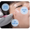 난곡서울한의원 | 관악구 바를정한방병원 안면마비 치료 2차 후기｜상담부터 치료 전 과정 상세 기록