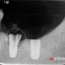 끄떡끄떡 이미지