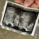 목포광주약국 | [난임기록] 광주 프레메디산부인과의원 동결 1차 성공+졸업