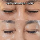 전주 눈가 이마 팔자주름 에스테틱더봄에서 해결