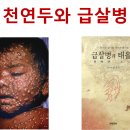 원숭이두창 비상사태, 괴질역병 비상사태 이미지