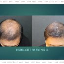이지성형외과 이미지