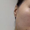 23-C | 오피겐 순수 비타민C 23% 세럼 후기｜고함량 비타민세럼으로 피부톤 개선 제대로 느끼기