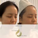 김해 장유 웨이브온다 &amp; 써마튠 윤곽리프팅 관리 후기, 골드테라피에서 받아본 솔직 후기