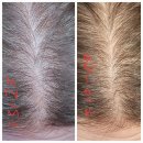 탈모+얇은 모발 강화 영양제 추천 내돈내산 사용후기 Advanced Trichology FoliGROWTH™