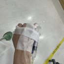 종가로(3)R | 림프종 투병일기(10) - 3차 항암(R-CHOP) 후 반응 평가(CT, PET-CT)