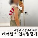센스 | 연속혈당기 추천 케어센스에어 리브레 후기 정확도 혈당비교