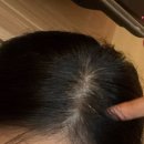 디지유통 | 이원경내과 후기 (단약 4달 +1kg/유지/탈모)