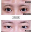 에프아이성형외과의원 이미지