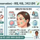 냉동난자 시술 후기 (결심 계기, 채취 과정, 회복 현실)