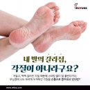 나도손톱 레푸스 개봉점 이미지