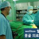 몽골 해외의료연수진, 웰튼병원의 선진화된 인공관절수술 참관위해 방문! 이미지