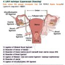 단식광대 | 소회(所懷)