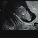 동행의원 | 남편과 함께 들은 아기 심장소리, 9주차 여성의원 첫 동행 후기