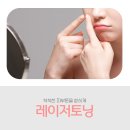 광주주근깨 과다하게 몰려있는 색소질환 치료법 이미지