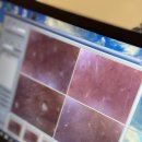 B10 | 동성로 모공관리, 여드름관리 B10에스테틱 후기