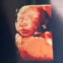 연세봄산부인과의원 이미지