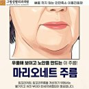 그림성형외과의원 | 마리오네트 주름 보톡스 후기 내돈내산 망하지 않는 방법