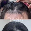 라헨느헤어라인