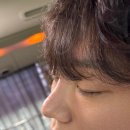 복코돼지 | 남자 코수술 내돈내산 (복코 주먹코 낮은코 콧볼축소 비염수술 첫수술) 붓기 가격 등 후기