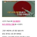 [일반] 백신 스파이크단백질 해독-낫토 청국장 된장 (나토키니아제) 이미지