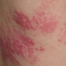 현대제철문화센터최대성한의원 이미지