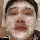 인산한의원 | 회기 인산한의원 미주란 시술 체험 후기
