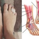 생활 건강 테이핑 이미지