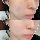 리브에스테틱 - 서구 | 대전 괴정동 피부관리 리브온에스테틱 닥토필 웨딩관리 추천후기
