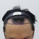 압구정맘모스헤어라인의원 이미지