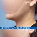볼독